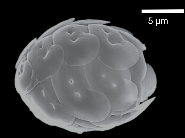 X Rays And Spectroscopy To Study Microalgae New Insights Into